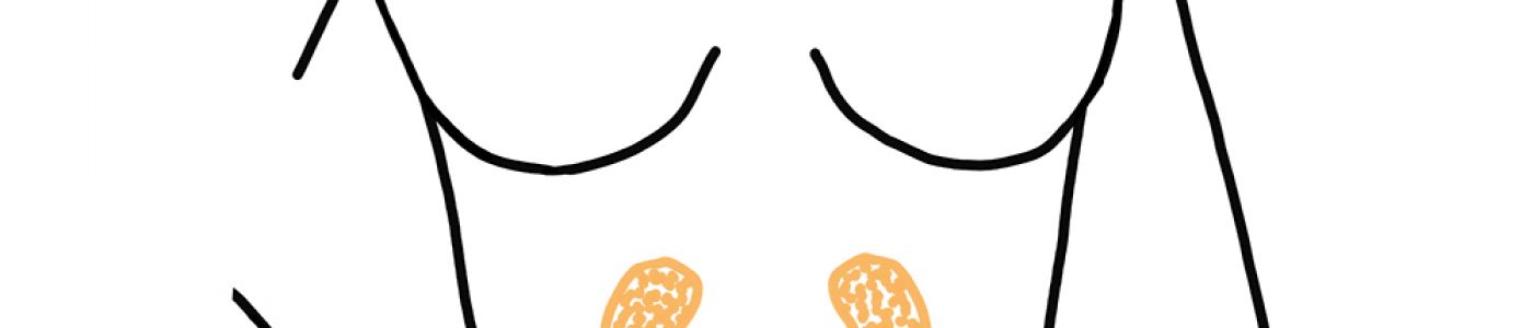 Come prevenire le infezioni alle vie urinarie?