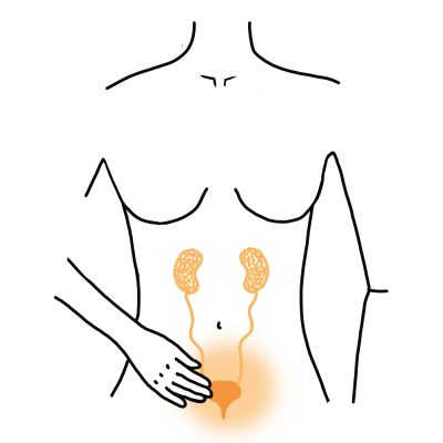 Come prevenire le infezioni alle vie urinarie?